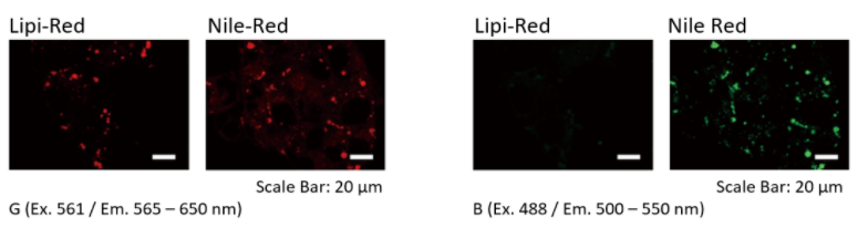 Lipi-Red试剂货号：LD03 脂滴检测（红色）